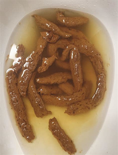 rate my poop|Meet the People Who Rate Each Other’s Poop On Reddit